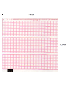 EKG-Papier, Siemens Cardiostat 3