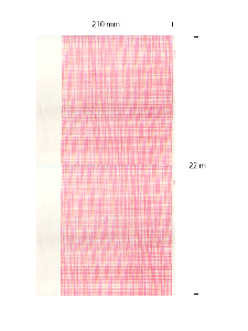 EKG-Papier, ELI 230 Mortara 
